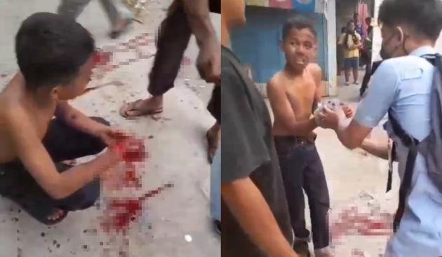 Pelajar SMP di Tangerang Jadi Korban Salah Sasaran, Gegara Nonton Tawuran, Tangan Nyaris Putus