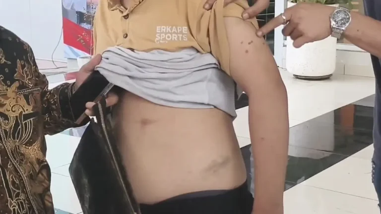 Lima Orang Diburu Polisi, Pelaku Penganiayaan Karyawan Koperasi Buron